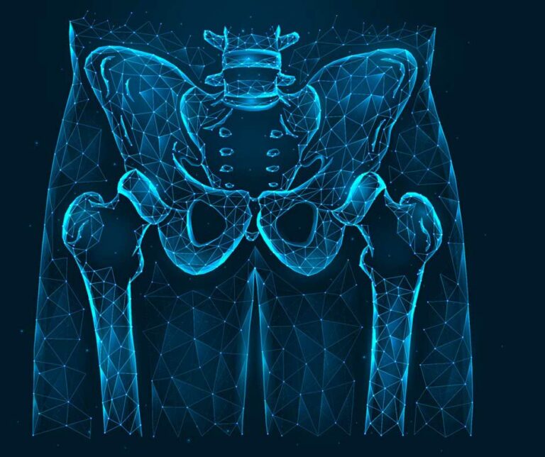 Femoroacetabuläres Impingement Diagnostik Archive - Physio Meets ...