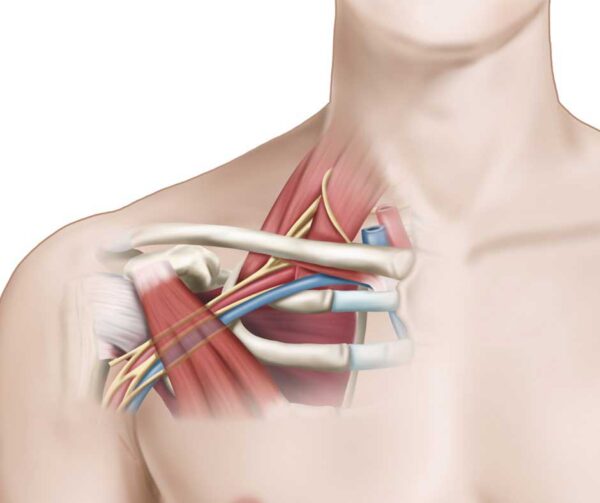 Pectoralis Minor Syndrom Archive Physio Meets Science Gmbh